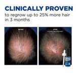 Men's Rogaine Extra Strength 5% раствор миноксидила для местного применения при выпадении и возобновлении роста волос, средство для местного лечения истонченных волос, запас на 1 месяц